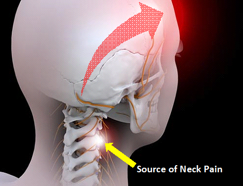 back of neck pain
