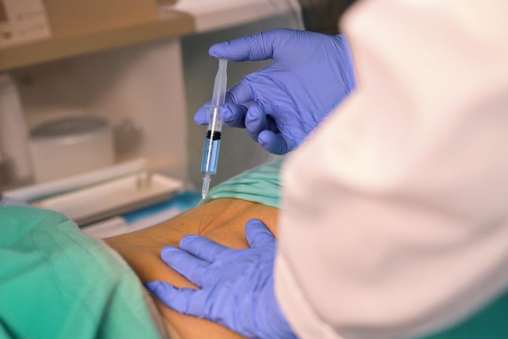 doctor performing epiduroscopy