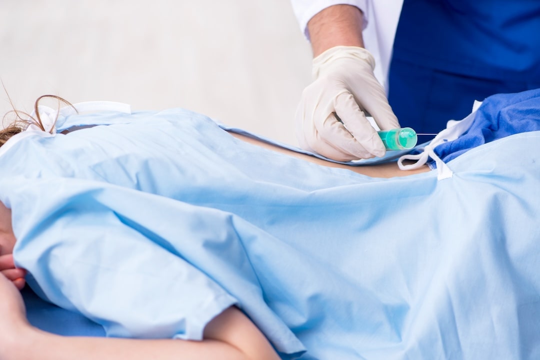 Sphenopalatine ganglion PRF Injection