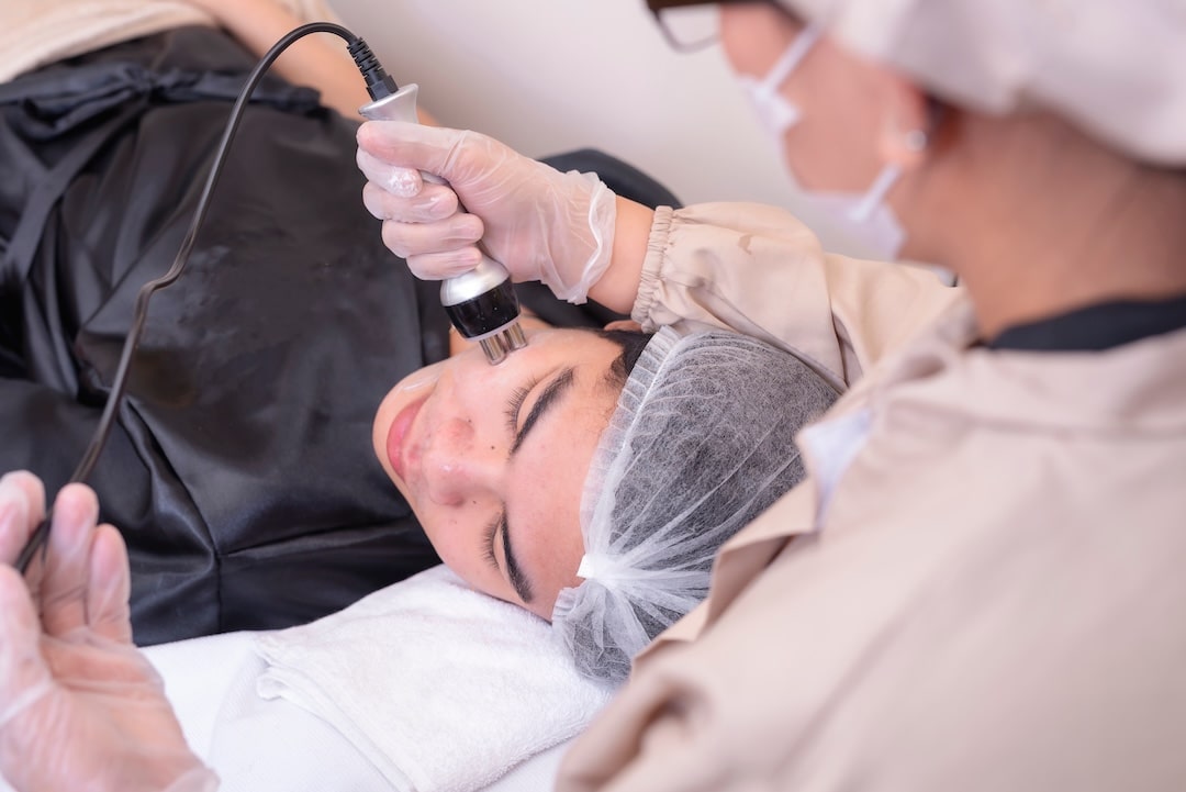 Trigeminal Ganglion Radiofrequency Rhizotomy